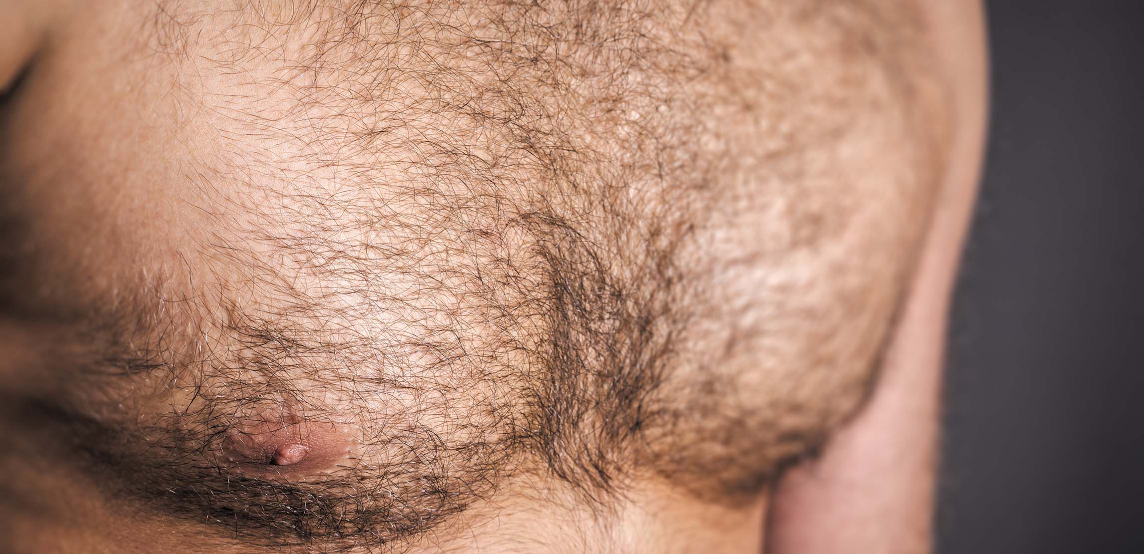 рост волос у мужчин на груди (119) фото