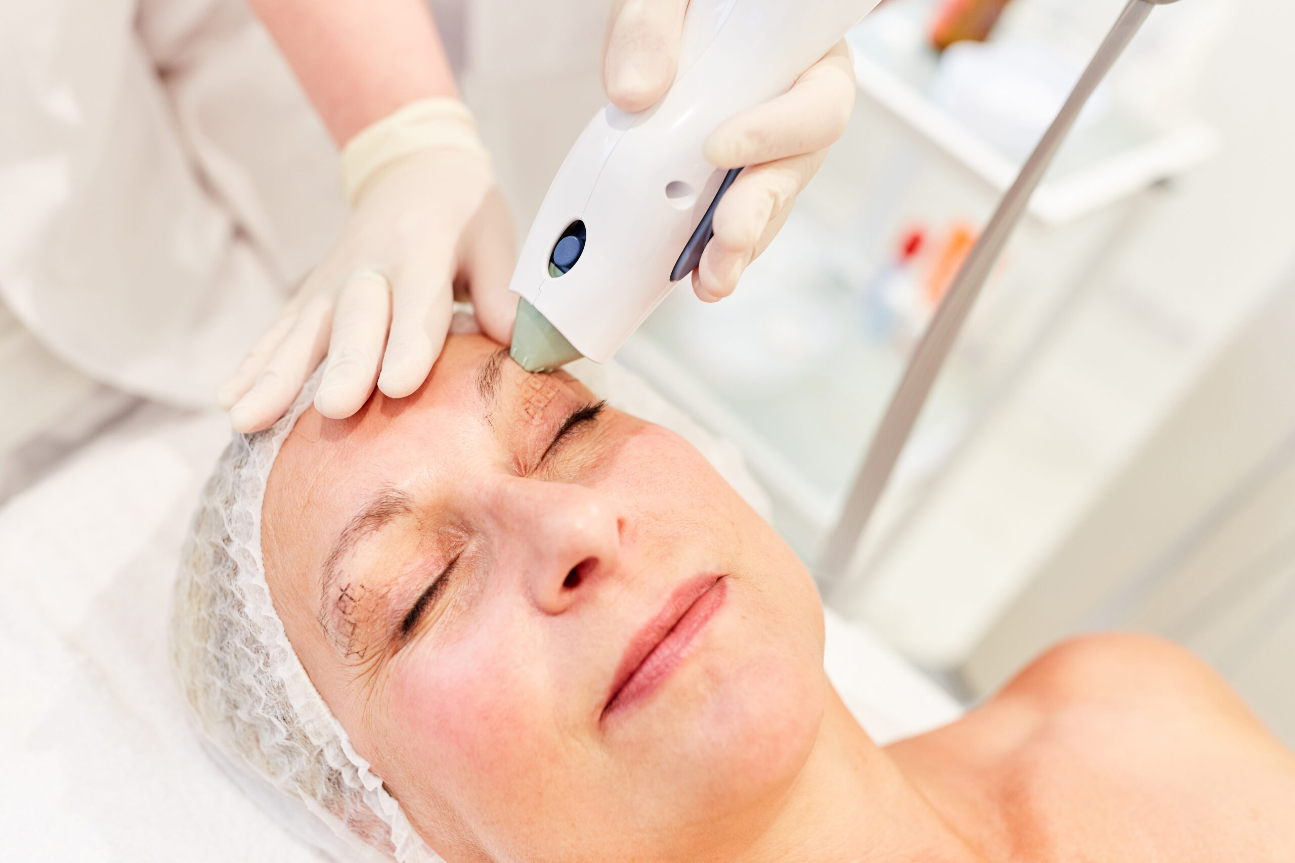 https://www.antiagingvancouver.com/wp-content/uploads/2023/02/Thermage-Skin-tightening-Anti-Aging-Clinic-scaled.jpg